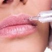 filler_labbra1